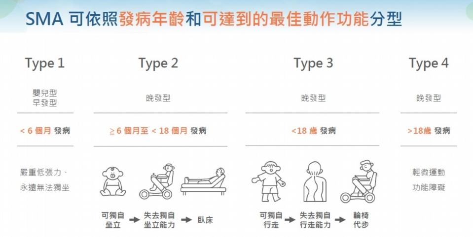 脊髓性肌肉萎縮症的特色、類型