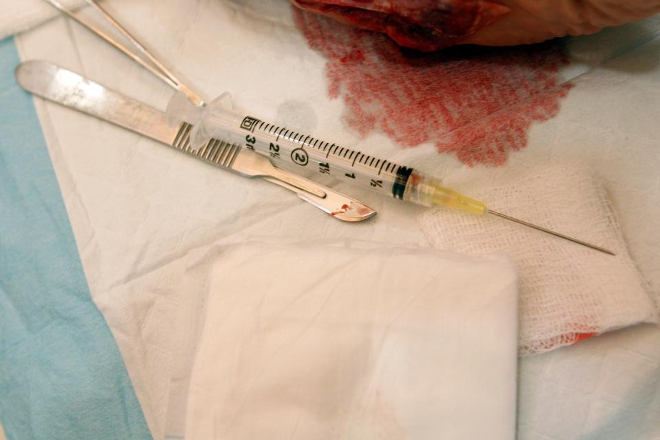 In this file photo, a health care provider injects a patient during a stem cell treatment.