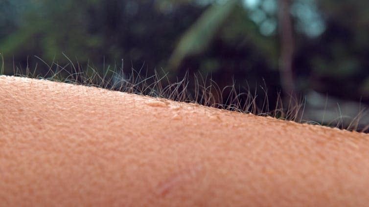 <span class="caption">ASMR can feel similar to the sensation of goosebumps, starting in the head and moving down the body.</span> <span class="attribution"><a class="link " href="https://www.shutterstock.com/image-photo/close-up-macro-dof-unknown-caucasian-1123812557?src=uL2-bV_fKiiBZpgnaEGqPg-1-5" rel="nofollow noopener" target="_blank" data-ylk="slk:Shutterstock;elm:context_link;itc:0;sec:content-canvas">Shutterstock</a></span>