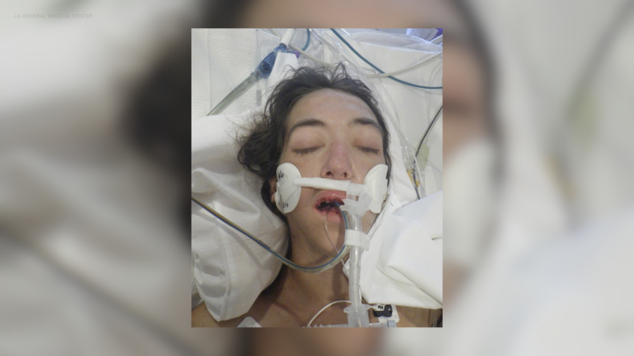 Los Angeles General Medical Center is asking for the public's help in identifying a woman who was found unresponsive in downtown Los Angeles on April 18, 2024. (Los Angeles General Medical Center)
