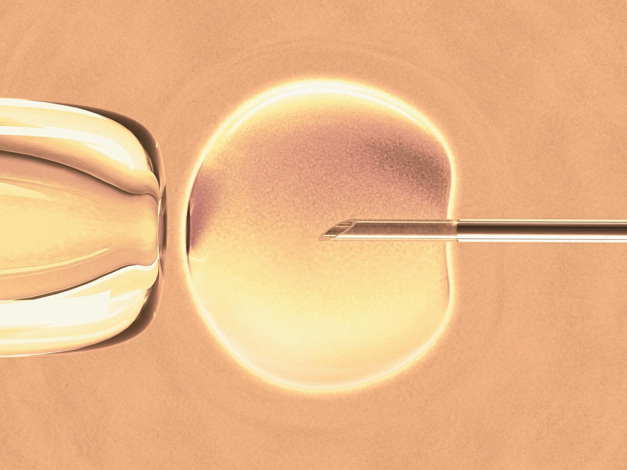 In vitro fertilization