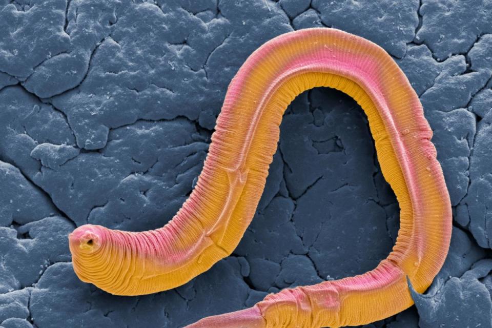C. elegans worm &lt;i&gt;(Image: Getty)&lt;/i&gt;