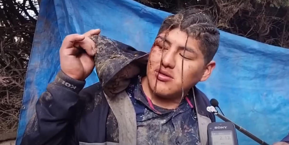 Victor Hugo Mica Alvarez, 30, bleeding from the head and covered in dirt after passing out at the Mother Earth festival.. 