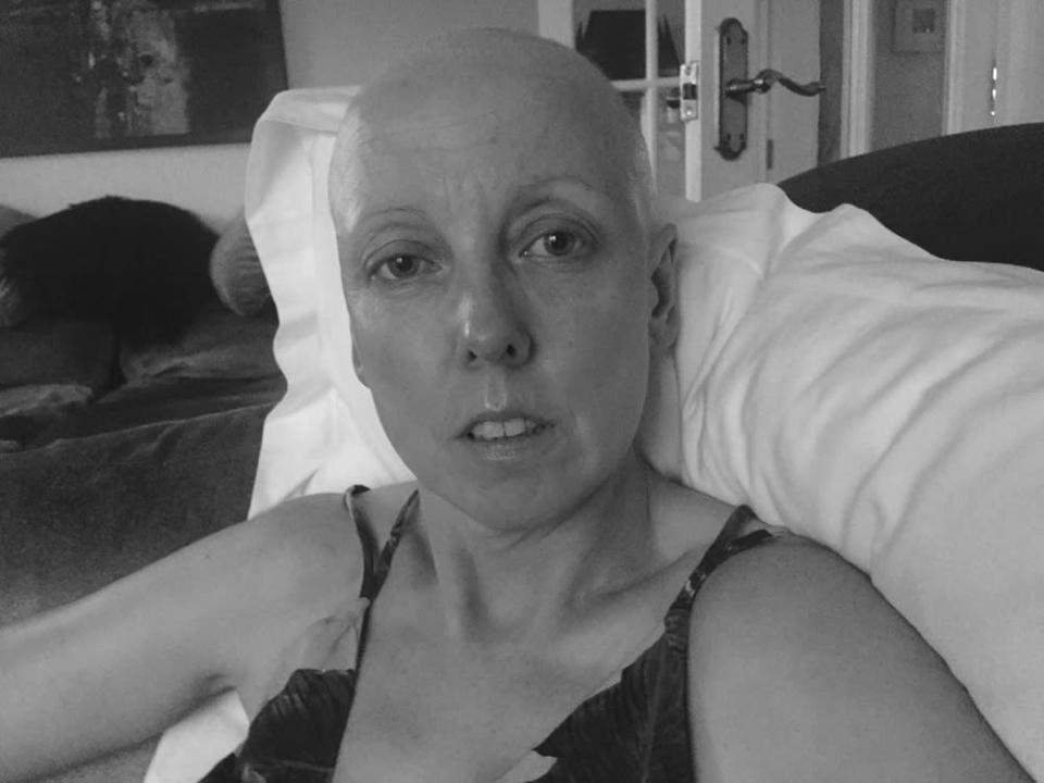 Tracey in June 2017 after losing her hair and eyebrows (Collect/PA Real Life)