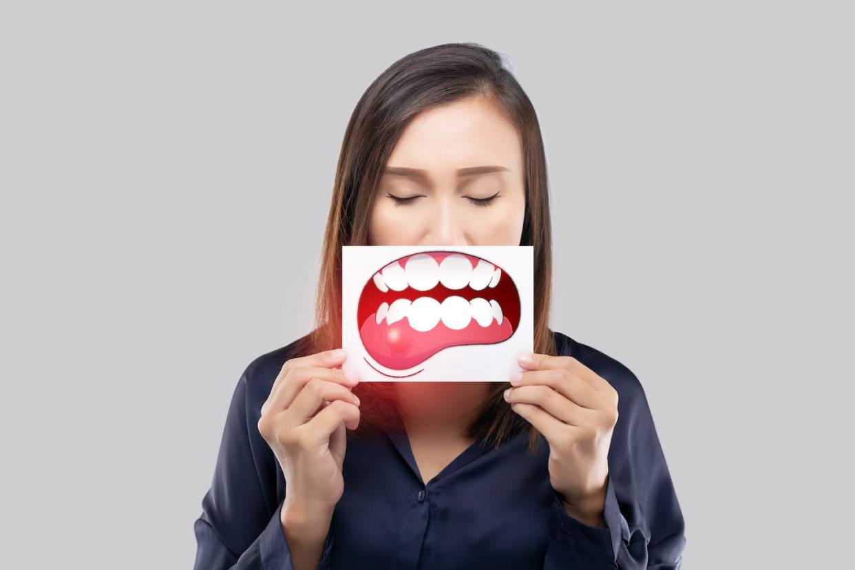 <a href="https://www.shutterstock.com/es/image-photo/periodontal-disease-gingivitis-inflammation-gums-2196675305" rel="nofollow noopener" target="_blank" data-ylk="slk:Shutterstock / Emily frost;elm:context_link;itc:0;sec:content-canvas" class="link ">Shutterstock / Emily frost</a>