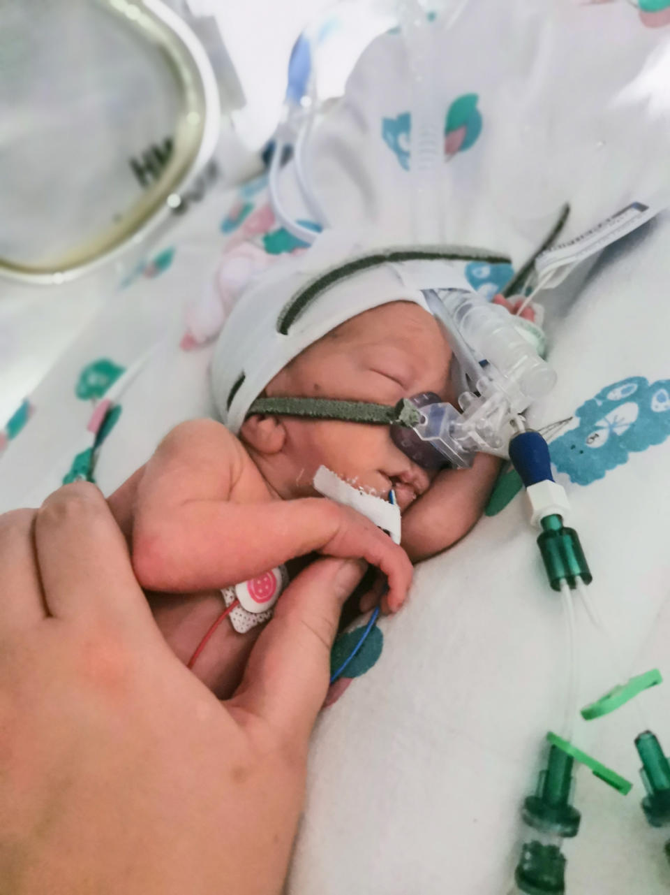 Martin Johnston holds the hand of his 12-week premature son Robbie one month after he was born (Johnston family/PA)