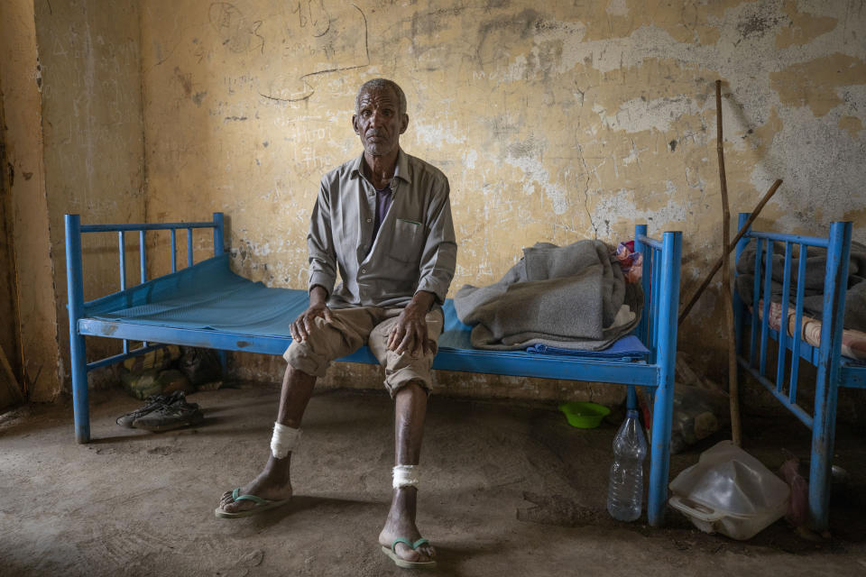 Guesh Tesla, 54-year-old carpenter and Tigrayan survivor from Rawyan, Ethiopia, shows wounds from sticks on his legs, inside a shelter, at the Hamdeyat Transition Center near the Sudan-Ethiopia border, eastern Sudan, Tuesday, Dec. 15, 2020. Tesla said he was taken to a courthouse that had been turned into a "slaughterhouse" by militia from the neighboring Amhara region. He said he heard the screams of men being killed, and managed to escape by crawling away at night. "I would never go back," Guesh said. (AP Photo/Nariman El-Mofty)