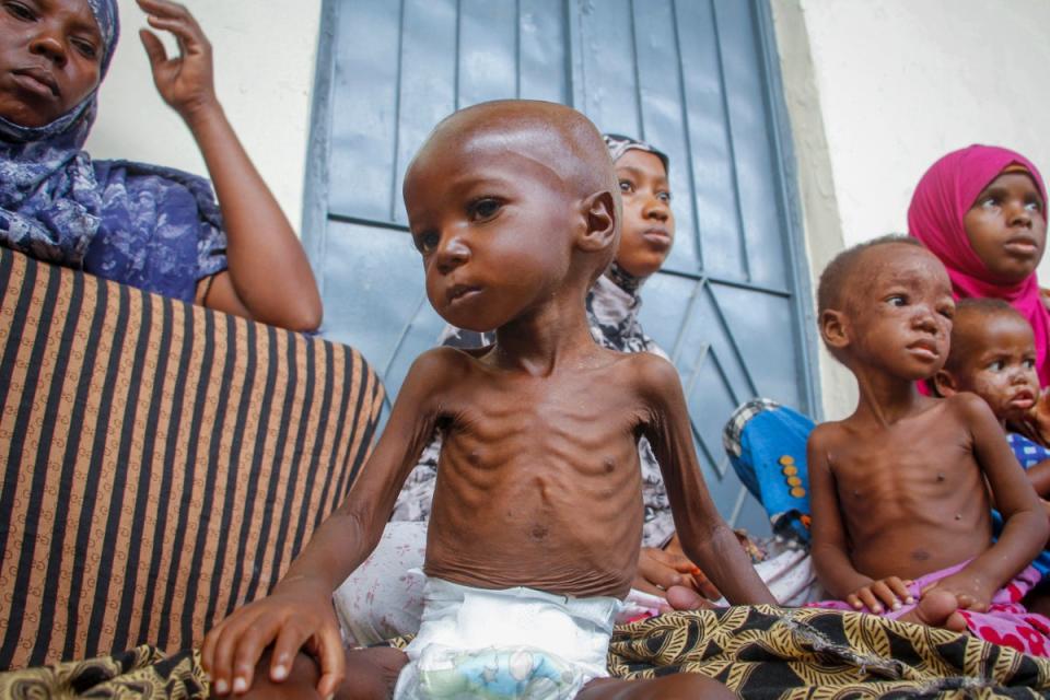 A malnourished two year-old child with his mother, left, who was recently displaced by drought, at a malnutrition stabilisation center run by Action against Hunger, in Mogadishu, Somalia in June 2022 (AP/Farah Abdi Warsameh)