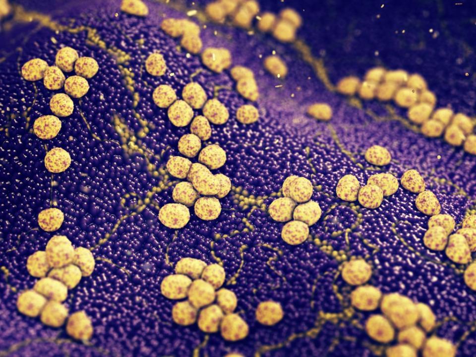 MRSA bacteria can cause a potentially fatal antibiotic-resistant infection. nobeastsofierce – stock.adobe.com