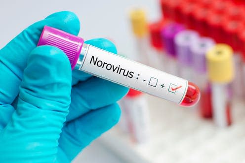   <span class="attribution"><a class="link " href="https://www.shutterstock.com/image-photo/blood-sample-positive-norovirus-1020471673?src=1VmHODbCdu2vPeaQz6_N8Q-1-1" rel="nofollow noopener" target="_blank" data-ylk="slk:www.shutterstock.com;elm:context_link;itc:0;sec:content-canvas">www.shutterstock.com</a></span>