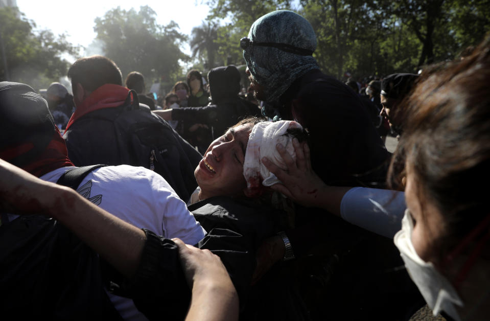 FILE - In this Oct. 24, 2019 file photo, protesters carry away an injured colleague during clashes with police in Santiago, Chile.In less than a month, more than 230 Chileans have lost sight in one eye, mostly due to the impact of pellets fired by the police during clashes with protesters demanding greater equality and improved social services. (AP Photo/Rodrigo Abd, File)