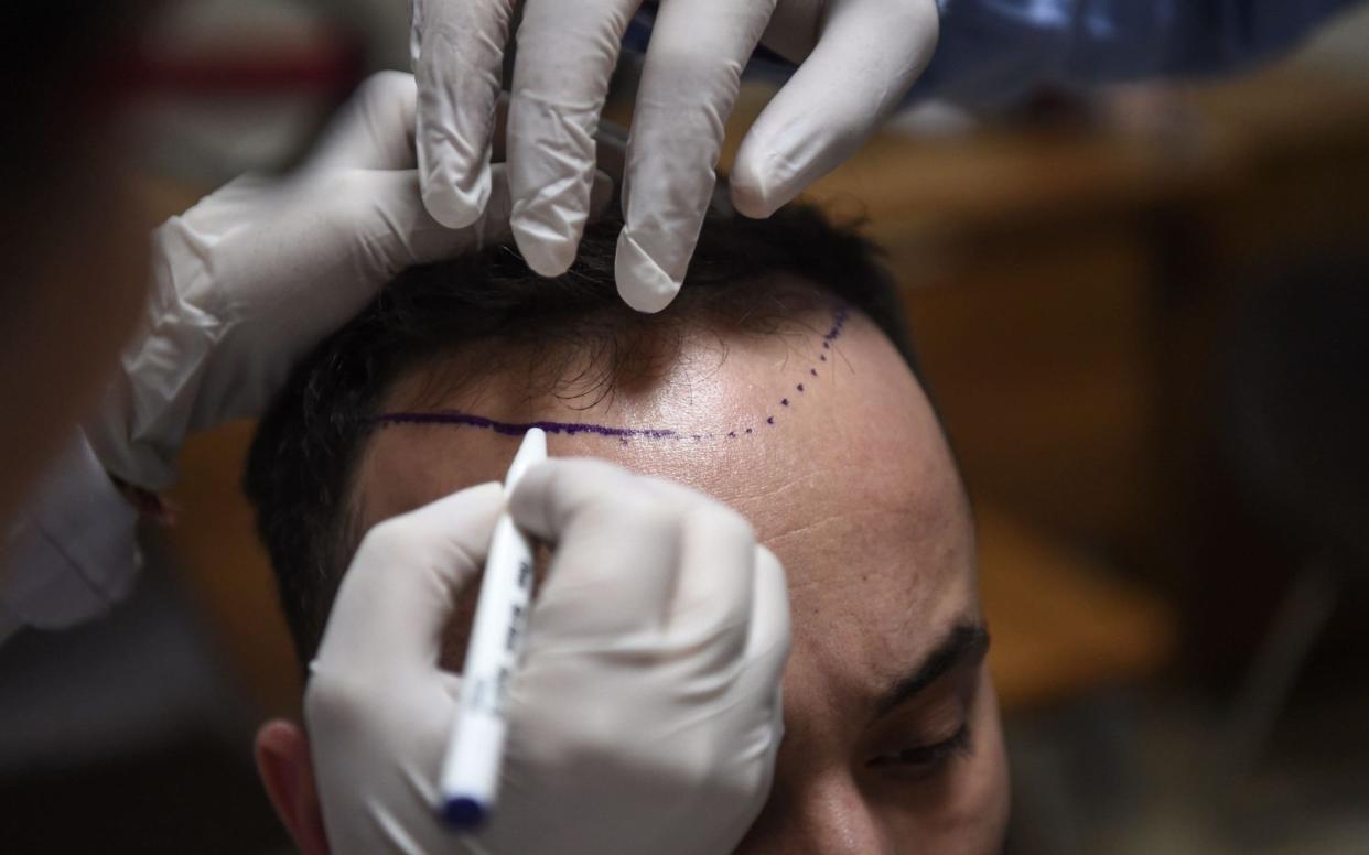 Always do your research before going under the cosmetic knife - AFP