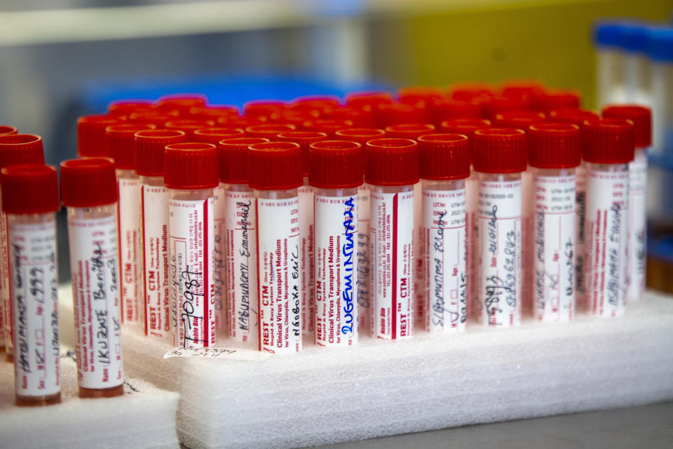 Patient samples to be tested for COVID-19 are seen at the Rwanda Biomedical Center in the capital Kigali, Rwanda, Tuesday, July 28, 2020. Like many countries, Rwanda is finding it impossible to test each of its citizens for the coronavirus amid shortages of supplies but researchers there have created an innovative approach using an algorithm to refine the process of pooled testing that's drawing attention beyond the African continent. (AP Photo)