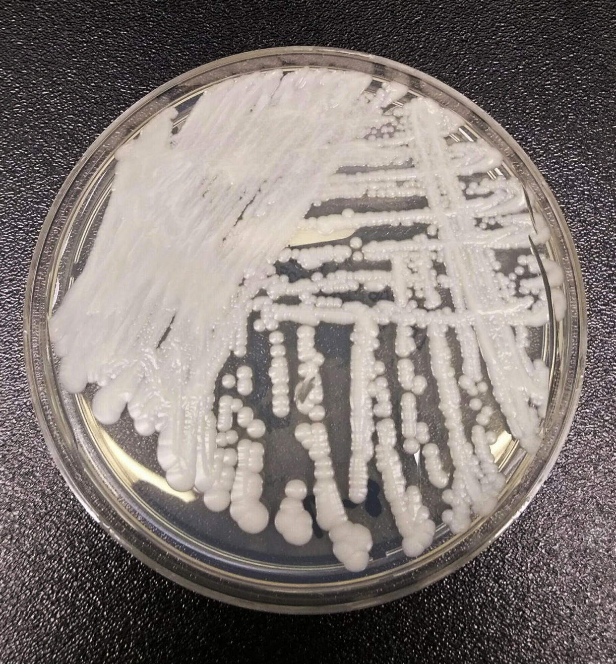 This undated photo made available by the Centers for Disease Control and Prevention shows a strain of Candida auris cultured in a petri dish at a CDC laboratory. On Tuesday, April 25, 2017, New York state health officials provided new details about a continuing outbreak of the infection. The count is 44 now, up from a half dozen last fall. The fungus is a harmful form of yeast that was first seen in a patient in 2009, in Japan. Scientists say it can be hard to identify with standard lab tests, and more cases are being reported as doctors are looking harder for it. (Shawn Lockhart/CDC via AP)