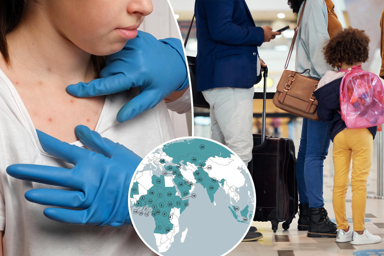 With 46 countries reporting large measles outbreaks, the Centers for Disease Control and Prevention is tightening guidance for American travelers.