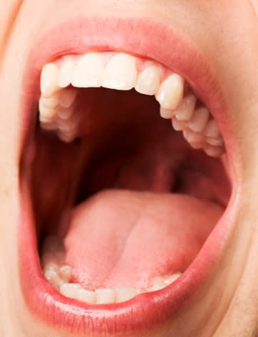 Ciertas bacterias en la boca pueden viajar al colon y afectarlo / Foto: Thinkstock
