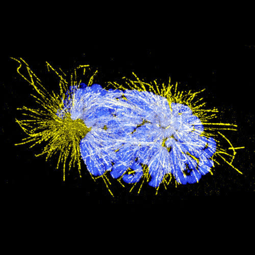 Cancerous cervical cells in 'prometaphase,' one of the beginning stages of cell division.  DNA-containing chromosomes stained in blue.  *Contest winner!