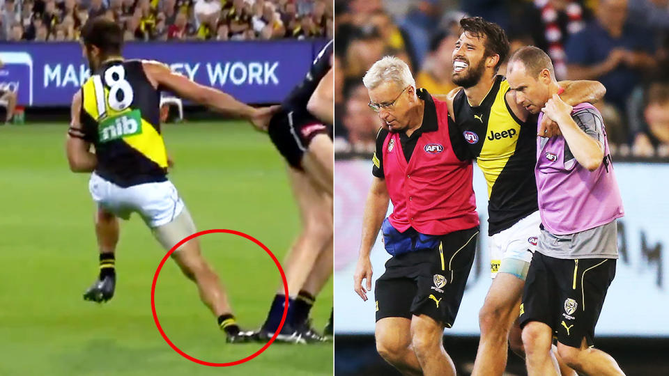 The nasty injury saw Rance come off in the third quarter. Pic: Channel 7/Getty