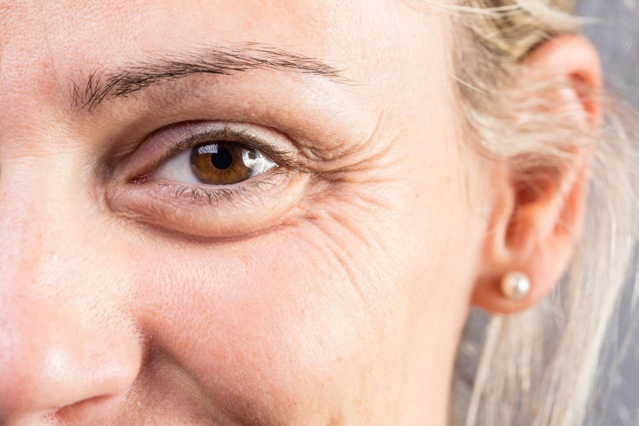 Closeup image of a woman with wrinkles around her eyes