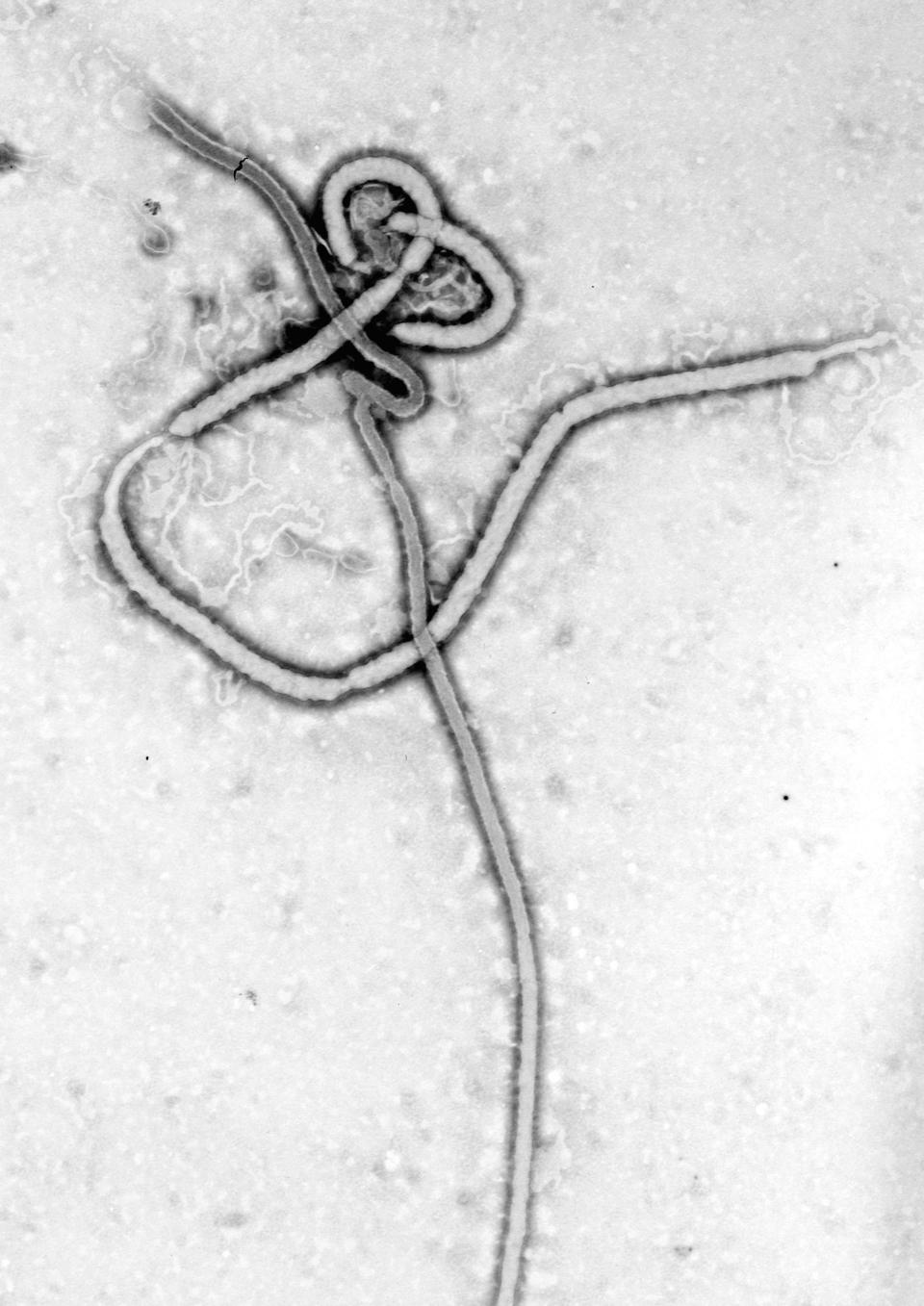 Imagen al microscopio del virus del ébola. (Crédito imagen: wikipedia).