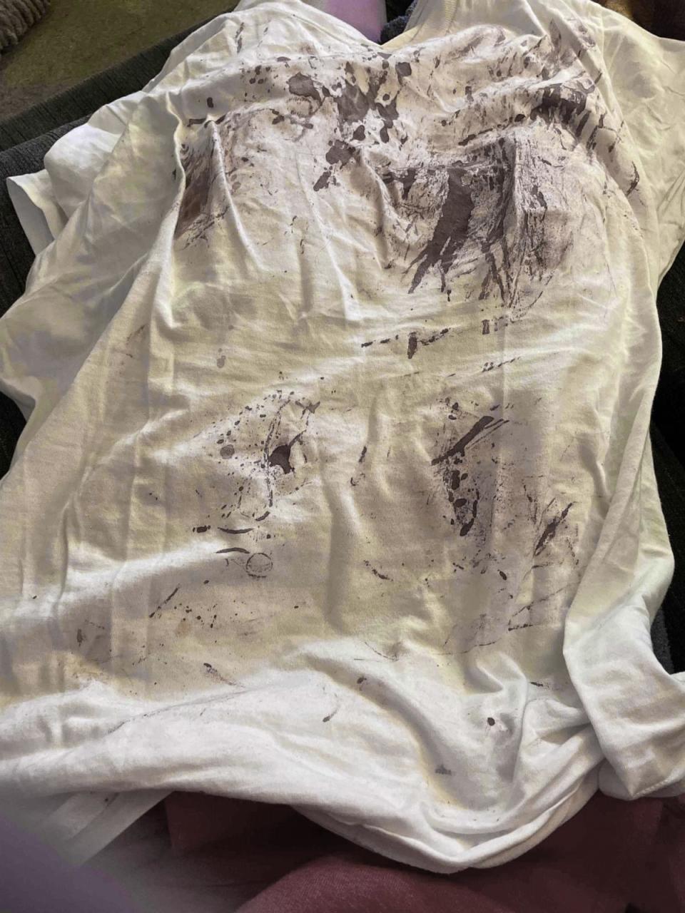 PHOTO: Desaturated image of Michelle Folson's t-shirt after the alleged assault, which included a facial fracture, concussive symptoms, bruising and lacerations to the head, and significant blood loss, according to a medical physician's letter. (Michelle Folson)