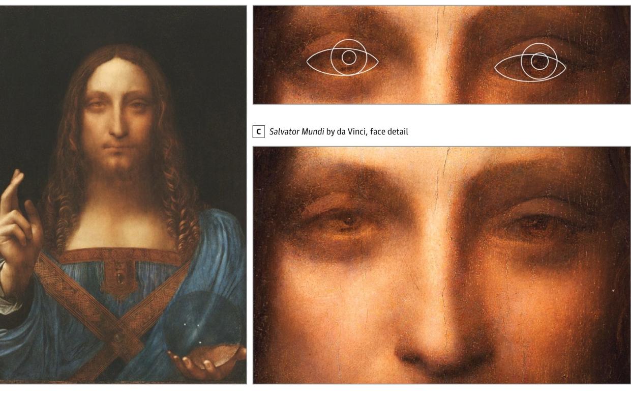 Leonardo used his own image as the face of Christ in the masterpiece Salvator Mundi and the pupiles are show to be diverging  - City, University of London