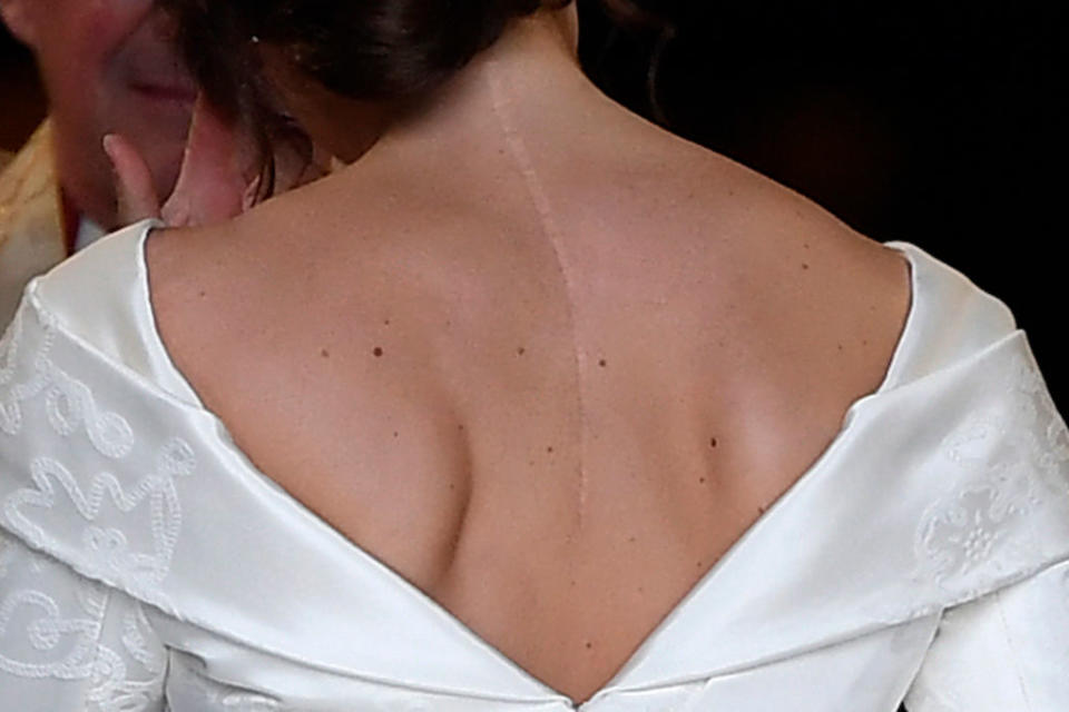 <em>Scar – Eugenie requested that her gown have a low back to show off her scar from back surgery (Picture: REUTERS/Toby Melville)</em>