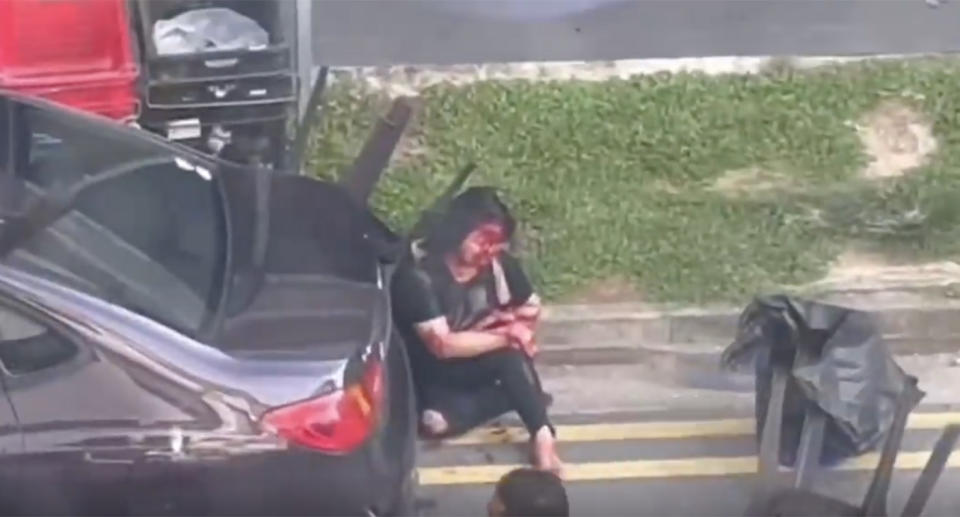 A woman sits in the gutter with blood over her face and arms.
