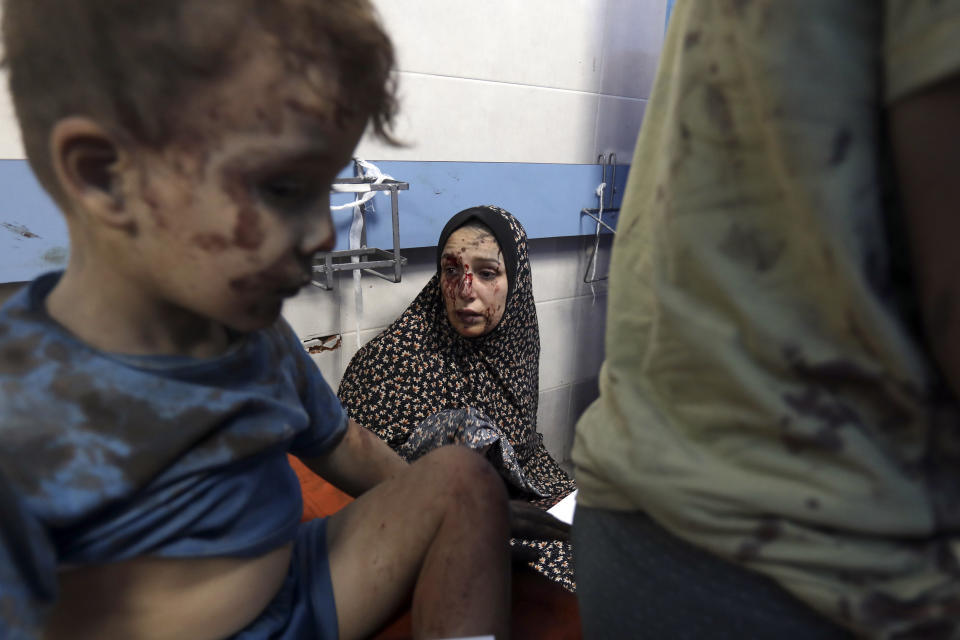 Wounded Palestinians receive treatment at the al-Shifa hospital, following Israeli airstrikes on Gaza City, Thursday, Oct. 26, 2023. (AP Photo/Abed Khaled)