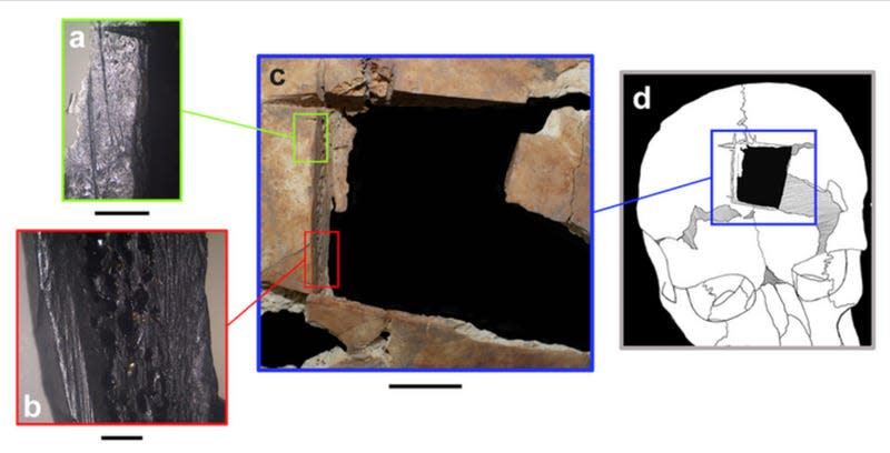 Graphic: Kalisher et al., 2023, PLOS ONE, CC-BY 4.0