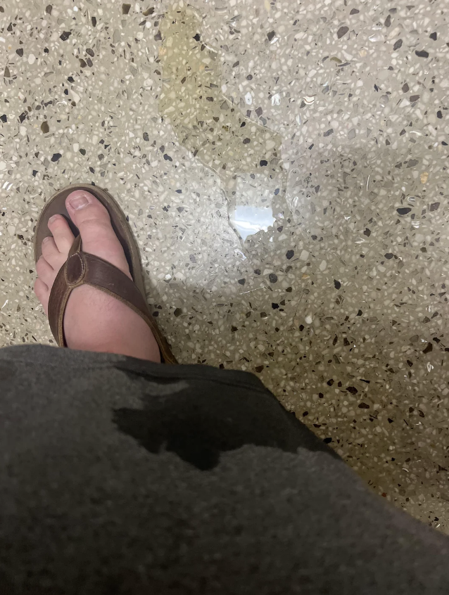 A person's foot wearing a brown sandal on a speckled floor, with a dark spot on their clothing