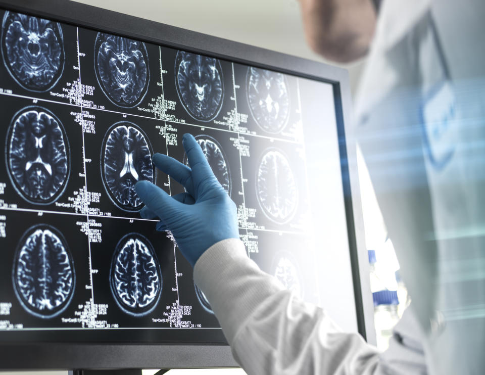 Doctor analyzing patients brain scan on screen. The expert says MRIs don't always pick up everything people might want to search for. (Getty)