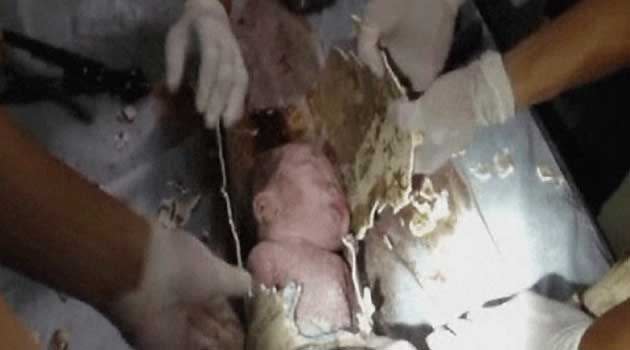 Firefighters and doctors rescue an abandoned newborn baby boy by cutting away a sewage pipe piece by piece. Photo: Reuters