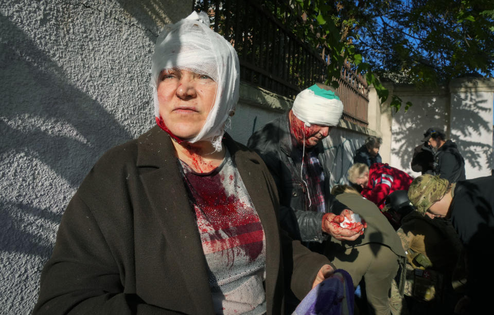 People receive medical treatment at the scene of Russian shelling, in Kyiv, Ukraine, Monday, Oct. 10, 2022. Two explosions rocked Kyiv early Monday following months of relative calm in the Ukrainian capital. (AP Photo/Efrem Lukatsky)