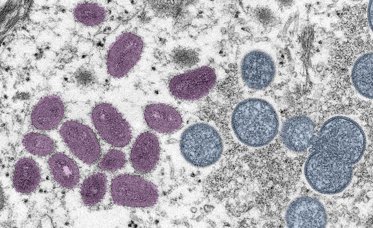 Digitally-colorized electron microscopic (EM) image depicting a monkeypox virion (virus particle), obtained from a clinical sample associated with a 2003 prairie dog outbreak, published June 6, 2022. The image depicts a thin section image from a human skin sample. On the left are mature, oval-shaped virus particles, and on the right are the crescents and spherical particles of immature virions. 