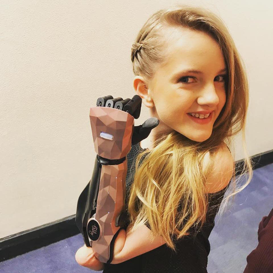 Lockey lost her arms to meningitis when she was a baby and has worked on the design and development of her &#39;Hero Arms&#39; with Open Bionics since she was nine. (Lockey family/SWNS)
