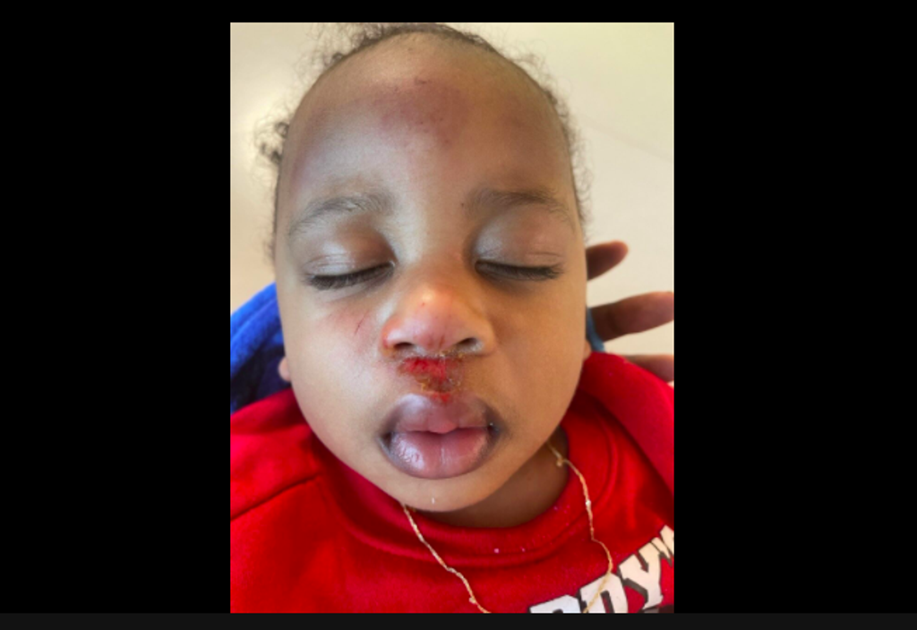One year old child allegedly injured while in police custody. (Moiya Dixon / ABC Channel 3)