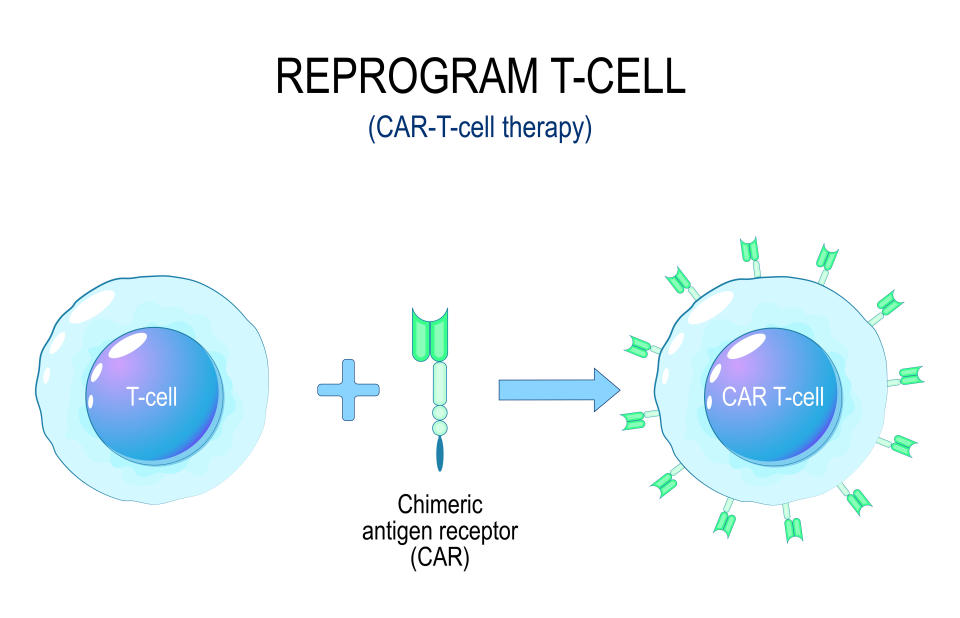 病人體內的T細胞會先被抽出，加入嵌合抗原受體（Chimeric Antigen Receptor），然後再注入體內，令自身免疫系統能辨識癌細胞，從而殺死它們。