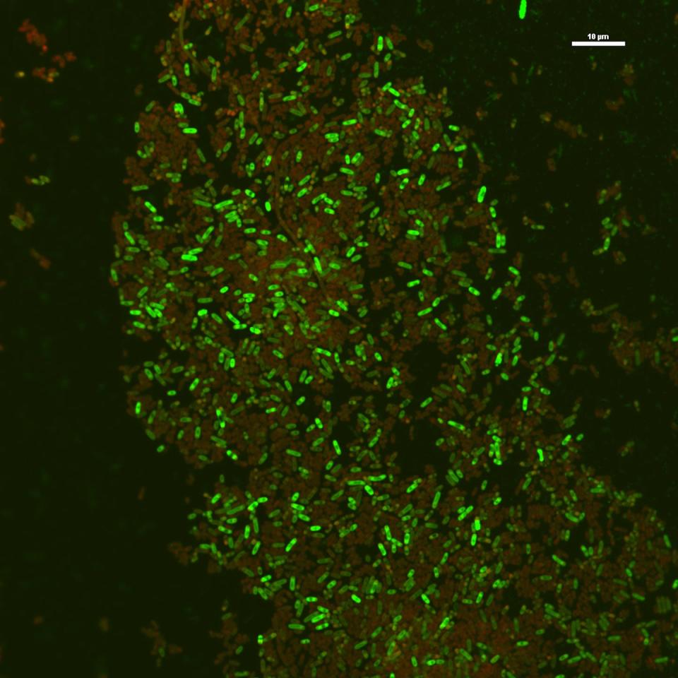 Imagen confocal de fluorescencia de bacterias (Escherichia coli) a las que se les ha aplicado la terapia fotodinámica. Las bacterias con fluorescencia roja son las bacterias que han muerto, mientras que las verdes son las que han resistido el tratamiento.