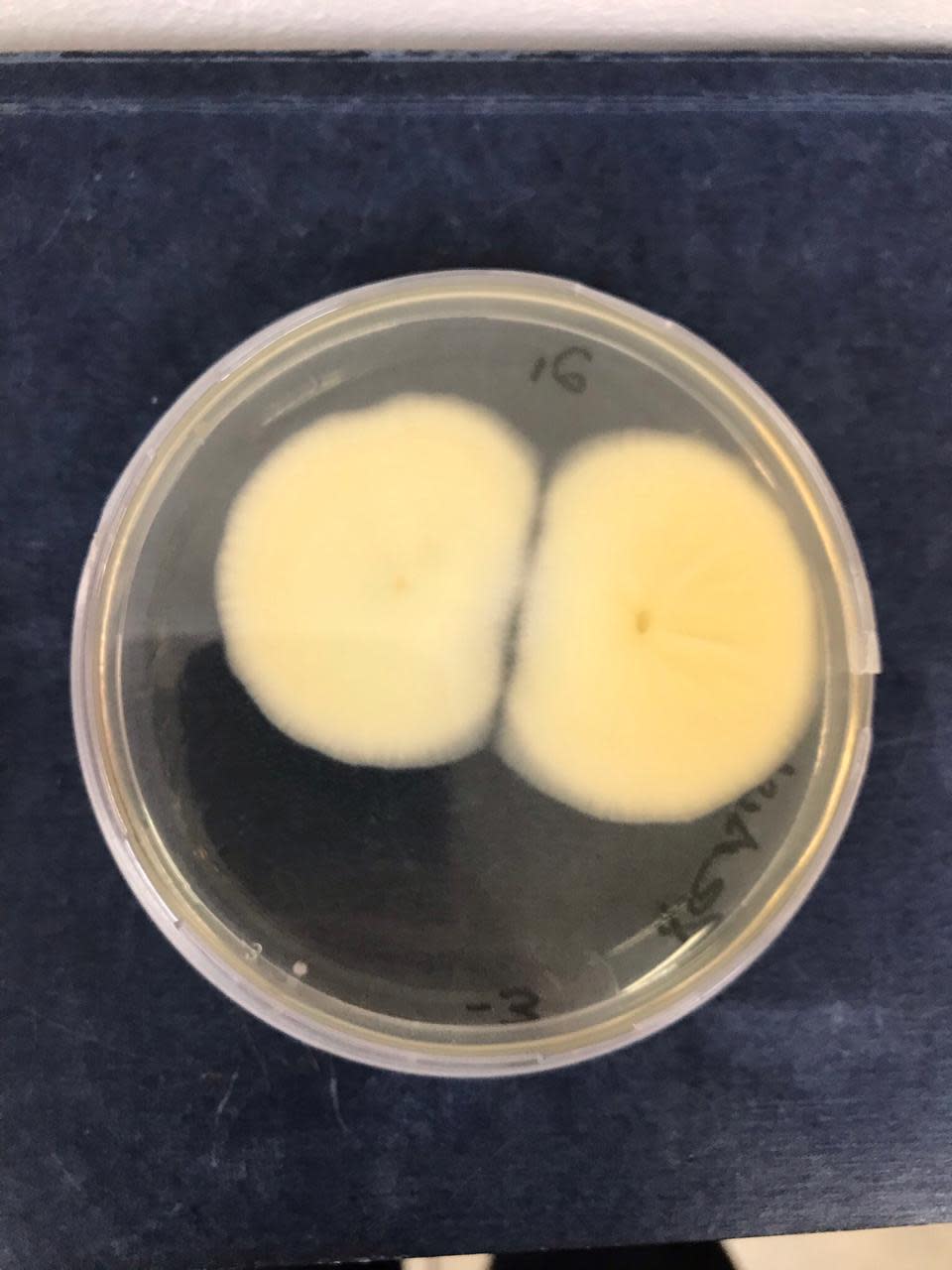 El estudio de un hongo en una placa de Elytron Biotech 
