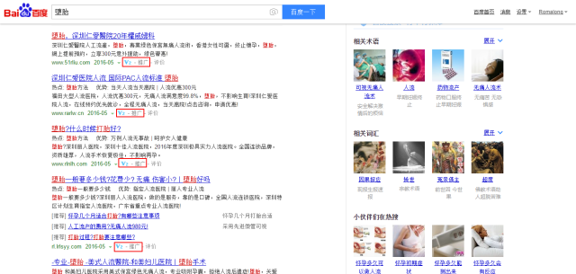 Searching “abortion” on Baidu leads to seven abortion clinic ads marked as “promotion” before any other information. One of them features a 980-yuan ($151) “painless abortion” package. <span class="inline-image-credit">(Screenshot from Baidu)</span>