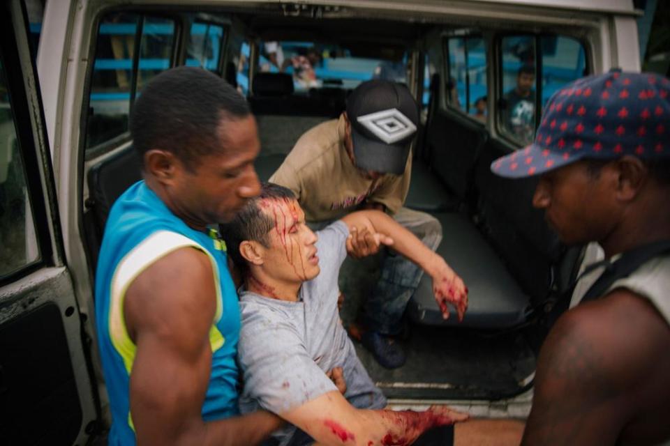 An injured Afghan refugee from the Manus Island detention centre is carried into the back of a vehicle after he was allegedly attacked by a group of Papua New Guinean men with an iron bar while out on day release on 15 August 2016.