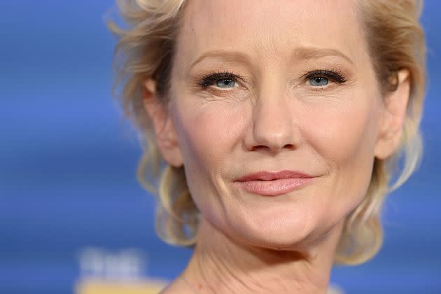 Actor Anne Heche suffered a devastating brain injury from a fiery car crash last week and is not expected to survive, a spokesperson for her family said. (Photo: Axelle/Bauer-Griffin via Getty Images)