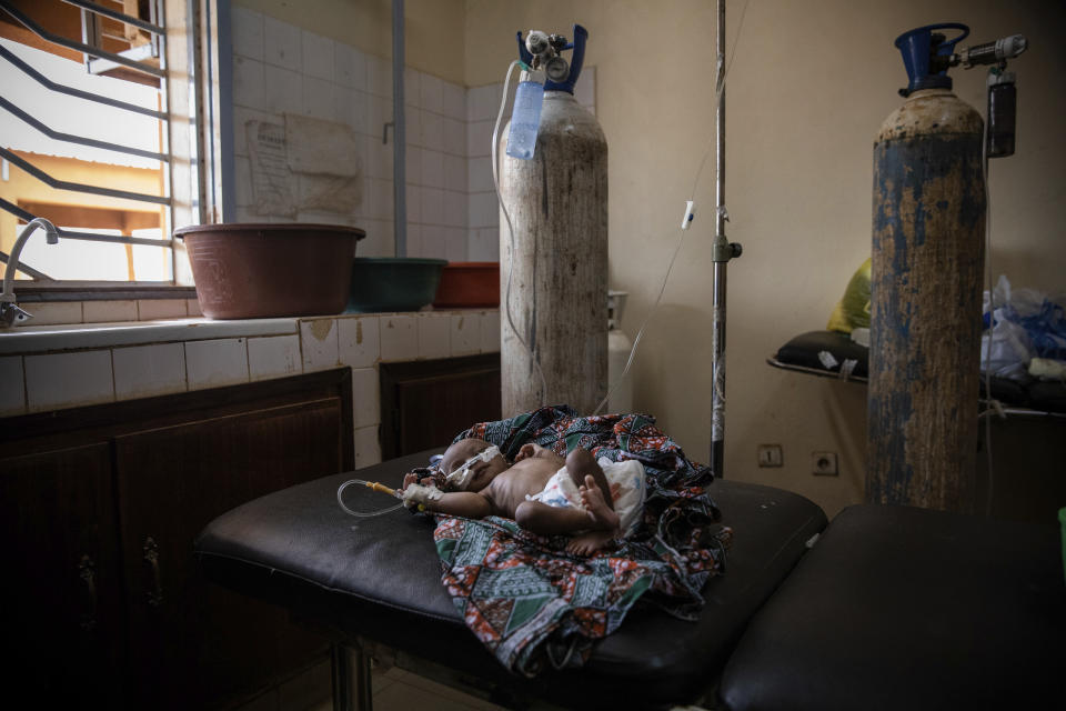 FILE - A malnourished baby is cared for in the pediatric department of Boulmiougou hospital in Ouagadougou, Burkina Faso, Friday April 15, 2022. The U.N. is warning that 18 million people in Africa’s Sahel region face severe hunger in the next three months. Two U.N. agencies are citing the impacts of war in Ukraine, the coronavirus pandemic, climate-induced shocks and rising costs – and warning that people may try to migrate out of the affected areas. (AP Photo/Sophie Garcia, File)