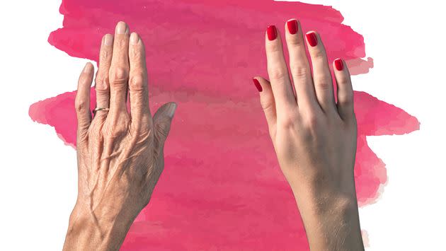 If you're looking to make major changes, over-the-counter hand lotions likely won't get the job done like a hand lift can. (Photo: Getty)