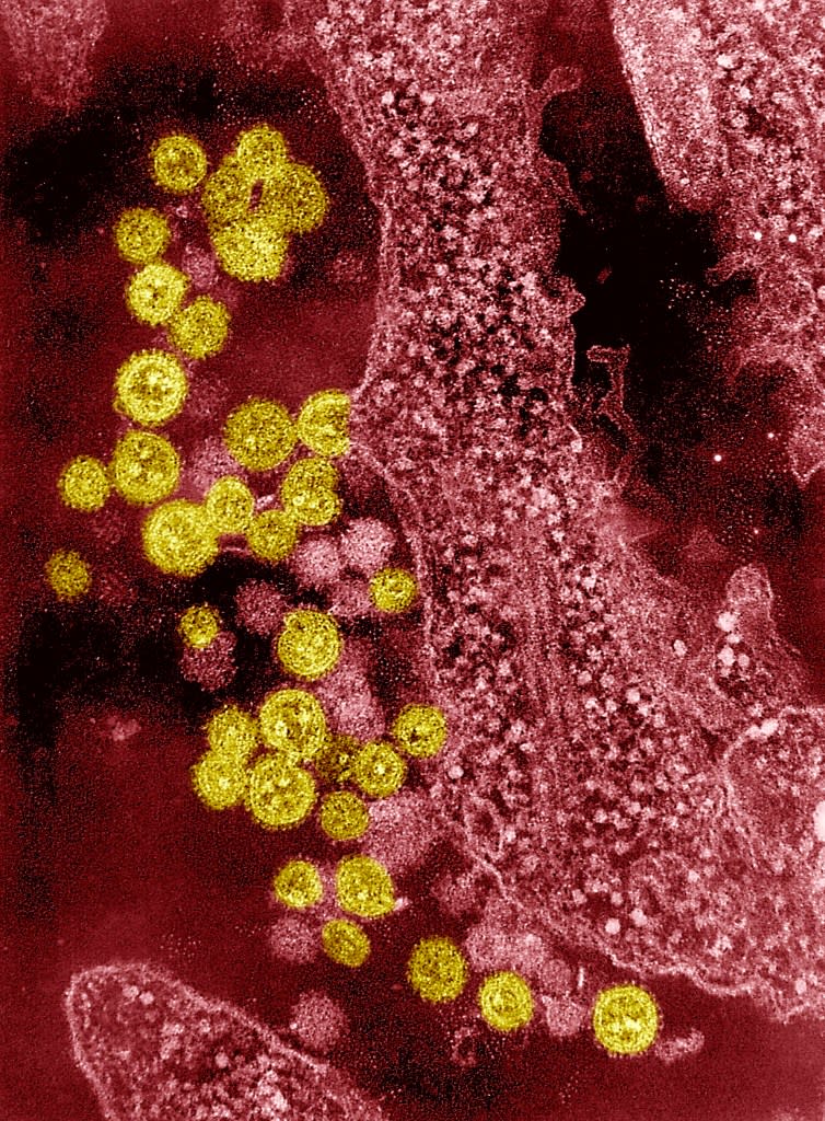 Electron Photomicrograph Of The Machupo Virus. Machupo Virus Is A Member Of The Arenavirus Family, Isolated In The Beni Province Of Bolivia In 1963; It Is The Agent Of Bolivian Hemorrhagic Fever. (Photo By BSIP/UIG Via Getty Images)