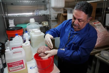 Dr. Vahram Haroutunian holds a human brain in a brain bank in the Bronx borough of New York City, New York, U.S. June 28, 2017. REUTERS/Carlo Allegri