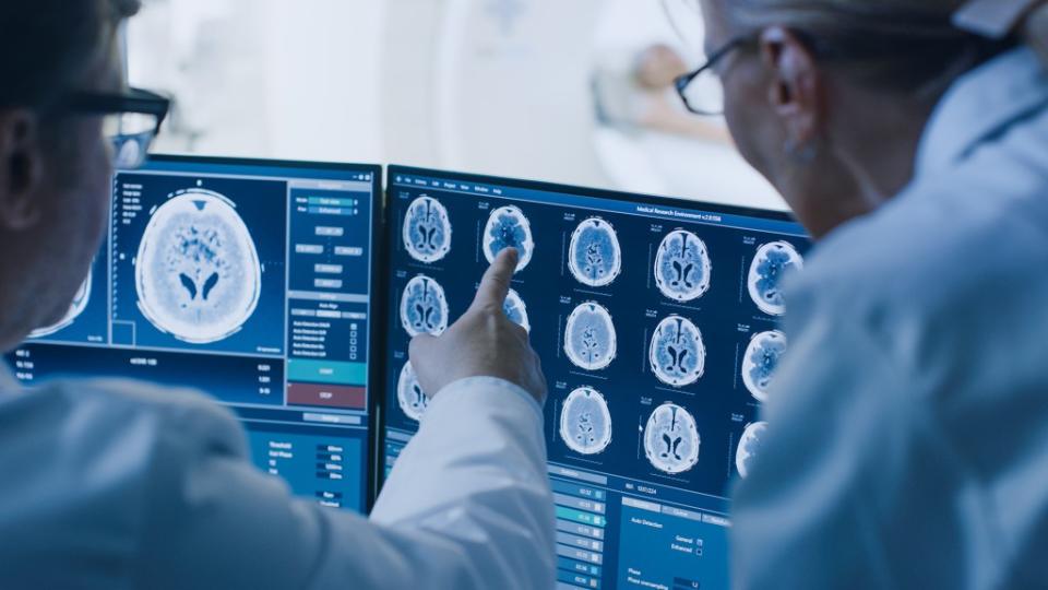 Scientists looked at MRIs from the Framingham Health Study, a community-based study that’s been going on for some 75 years. Gorodenkoff – stock.adobe.com