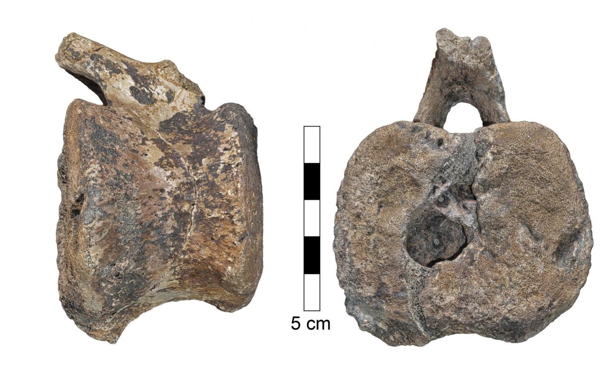 A disease still affecting humans today has been found in a dinosaur for the first time: SWNS