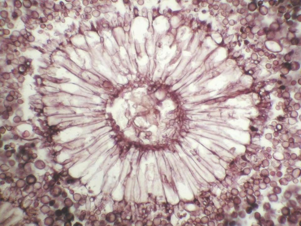 The conidial head, or fungal spore, of <em>Aspergillus</em>. <a href="https://flic.kr/p/9fuc1N" rel="nofollow noopener" target="_blank" data-ylk="slk:Nadeem Zafar/Dr. Yale Rosen Atlas of Pulmonary Pathology via Flickr;elm:context_link;itc:0;sec:content-canvas" class="link ">Nadeem Zafar/Dr. Yale Rosen Atlas of Pulmonary Pathology via Flickr</a>, <a href="http://creativecommons.org/licenses/by-sa/4.0/" rel="nofollow noopener" target="_blank" data-ylk="slk:CC BY-SA;elm:context_link;itc:0;sec:content-canvas" class="link ">CC BY-SA</a>